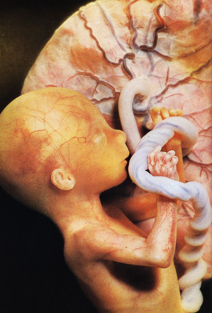 In its shattering effect, birth can only be paralleled by death - but does it float