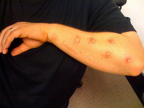 Paintball