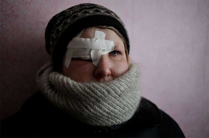Yulia Novomlynets, 18, waits to receive the humanitarian aid in the local Palace of Culture which is used as a bomb shelter in Mironovskiy