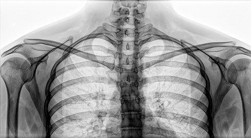 DeadFix » X-ray #ray