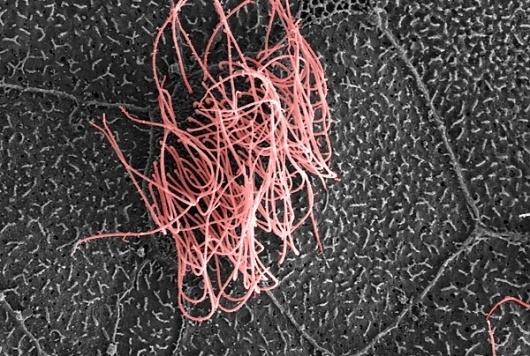 Ahem! These Cells Help Clear Your Lungs: Scientific American Gallery #cell