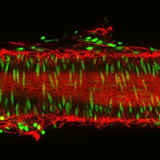 3-D Microscopy Casts Blood Vessel's Structure in New Light: Scientific American Gallery #micro #microworld