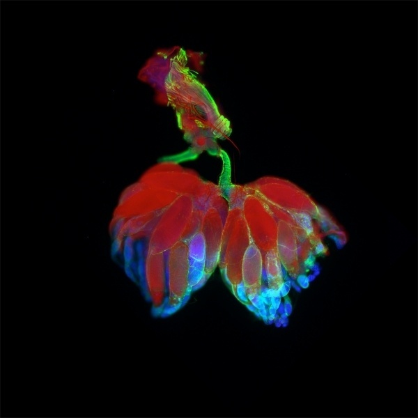 Extraordinary Microscope Photographs - The Big Picture - Boston.com #photography #microscope