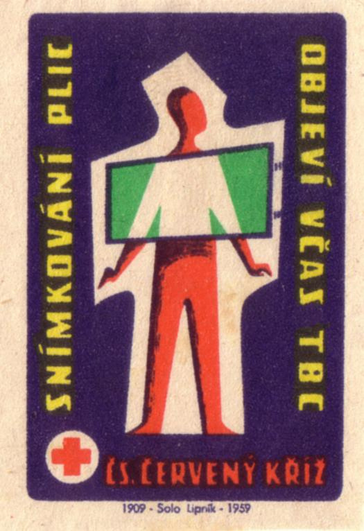 photo #matchbook