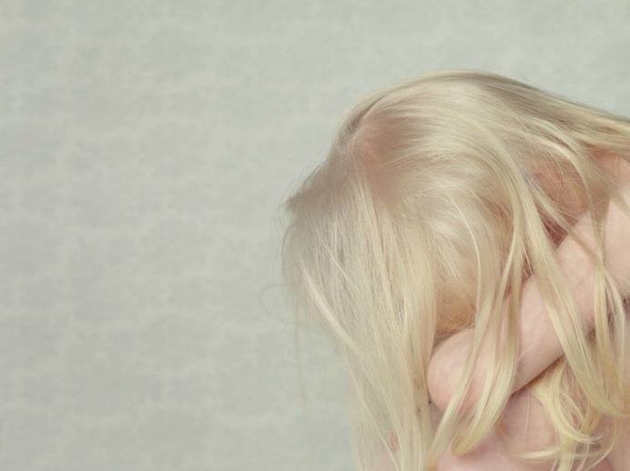 gustavo lacerda, albinos (3) #white #photo #hair #albino #blonde