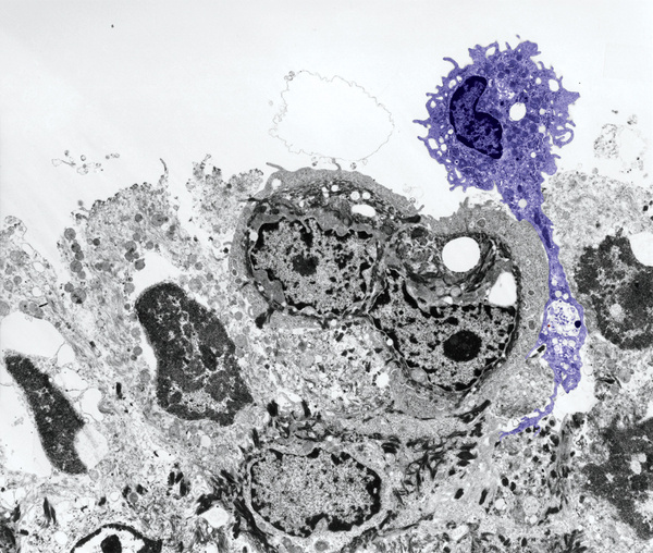 Front line Defenders via Cell Journal #science #biology