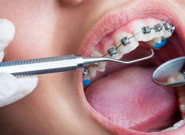 Le-Dental Dokter Gigi Tangerang – Dokter Gigi Tangerang Layanan dan perawatan gigi, lawat gigi, veneer, dokter gigi terbaik di Tangerang