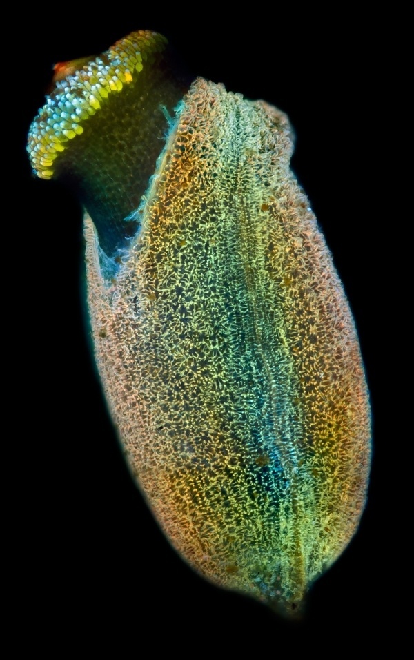 Extraordinary Microscope Photographs - The Big Picture - Boston.com #photography #microscope