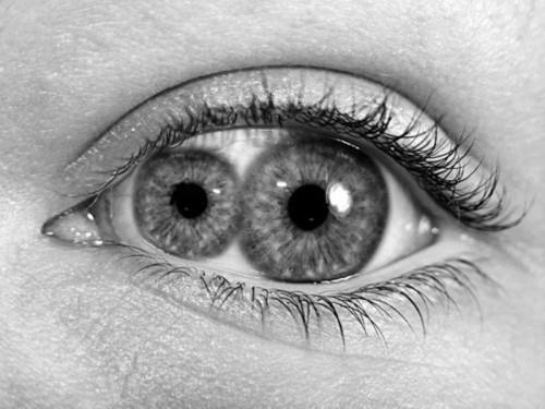 DeadFix » yeah its photoshoped #eyes