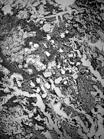 Typography of Tears - microscopic images of different tears #tears #texture