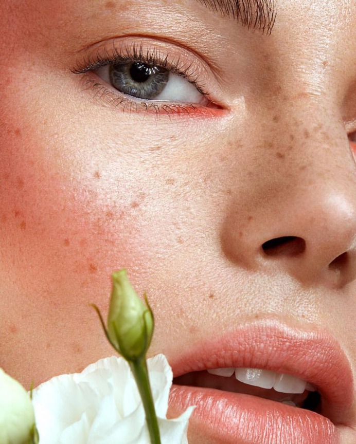 Breathtaking Portraits of Women With Freckles by Sven Barucha
