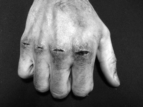 The Death of cool #split knuckles