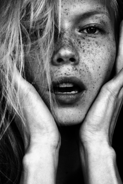 freckle #photography #freckles