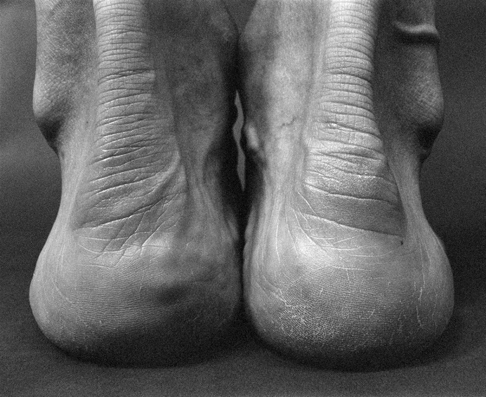 Photographs by Lucyna Kolendo :: Title: Bertrand Russell #white #sole #ankle #black #human #heel #photography #and #wrinkles #feet #beauty