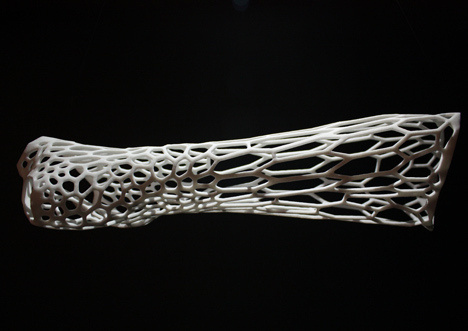 Cortex 3D-printed cast by Jake Evill #3d #print #hand #cast