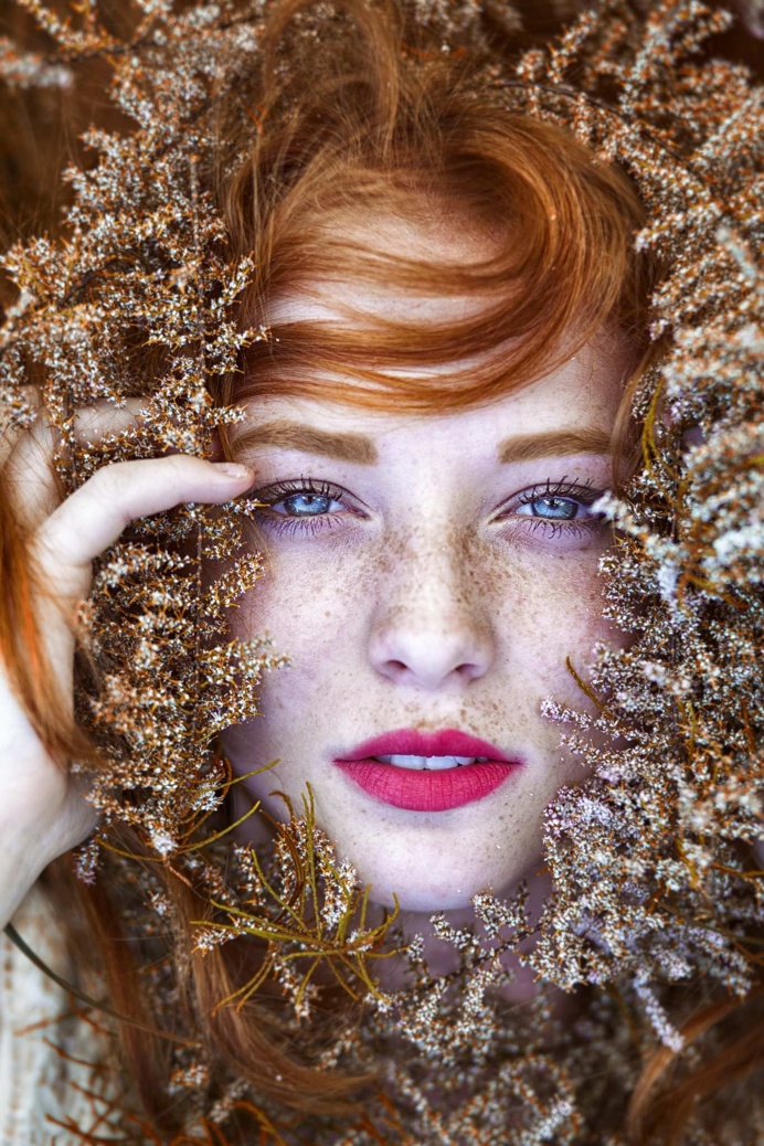 Bosnian Photographer Is Showing People The True Beauty of Freckles